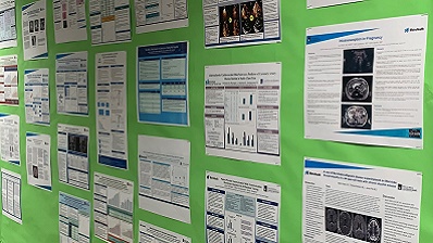 Internal Medicine Research at MetroHealth