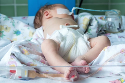 premature baby in NICU