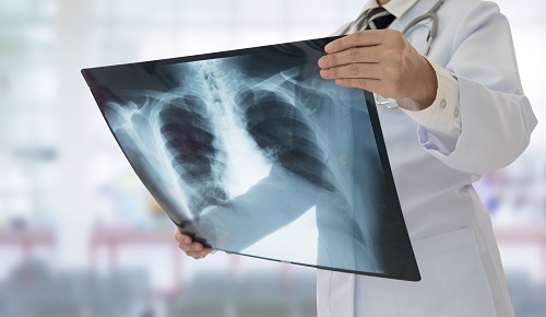 radiology gme metrohealth