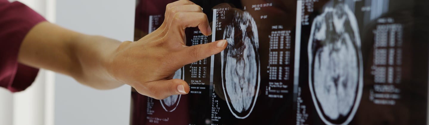 Brain imaging