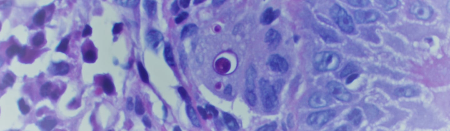 Cytopathology GME image