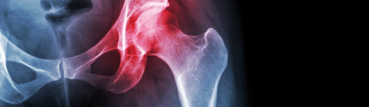 Joint X-Ray Rheumatology