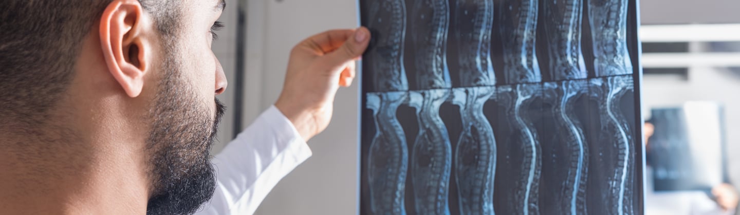 Doctor examining as spinal X-ray
