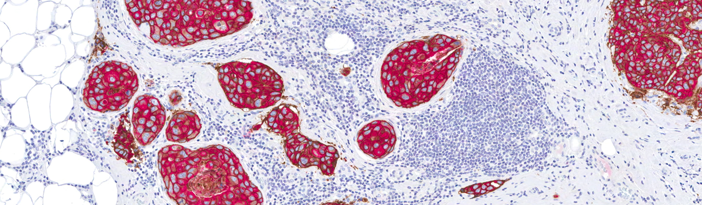 Pathology slid